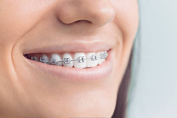 Best Teeth Whitening  in Odell, OR